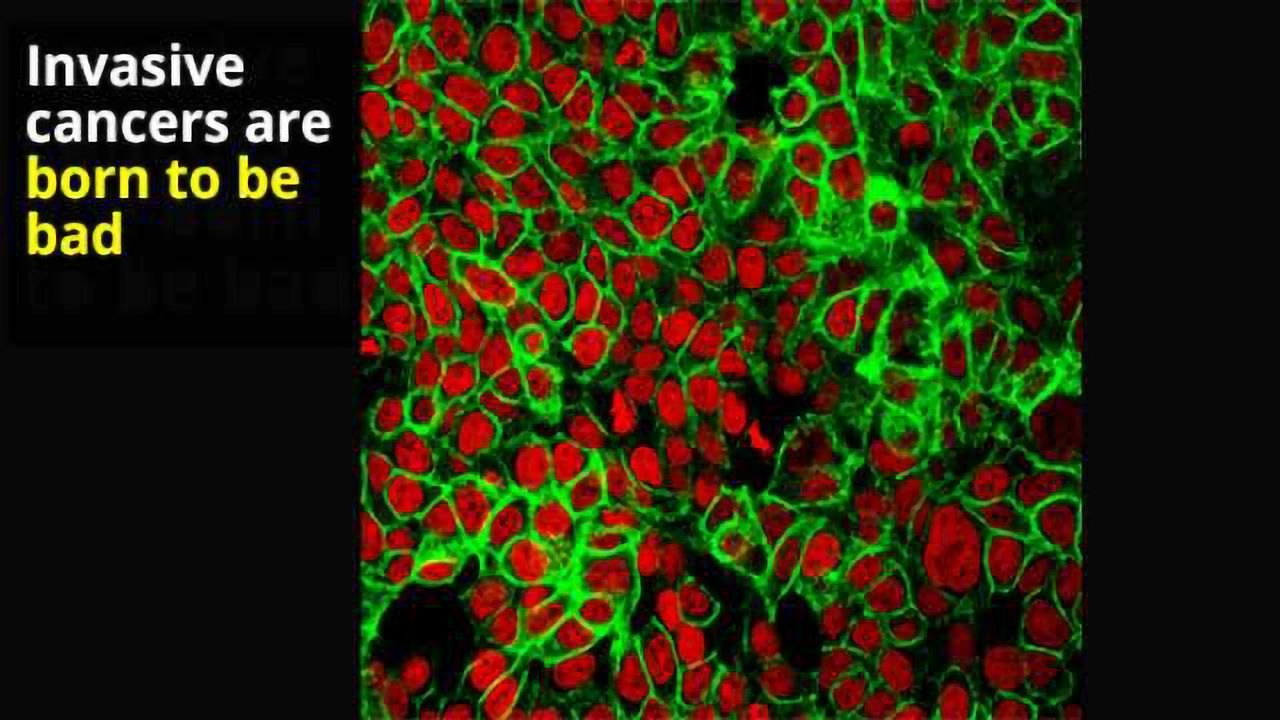 Deadly Cancers Show Early, Detectable Differences from Benign Tumors