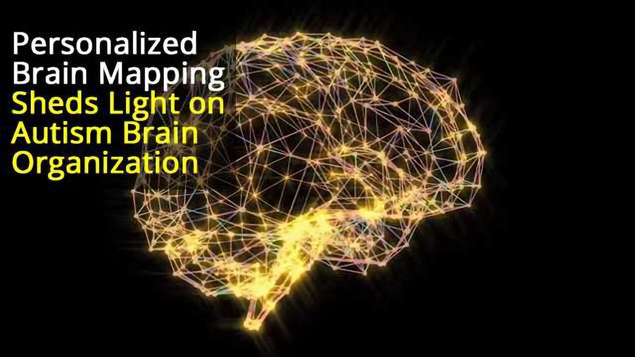 Differences in Spatial Layout of Brain Networks in People With Autism