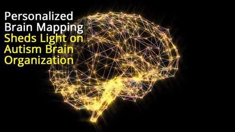 Differences in Spatial Layout of Brain Networks in People With Autism