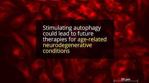 New Way to Stimulate Cellular Recycling Process