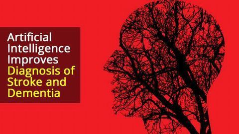 Machine Learning Improves Stroke, Dementia Diagnosis in Commonest Form of Brain Scan