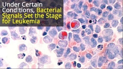 Bacterial Signals Crucial to the Development of Precursor Condition to Leukemia