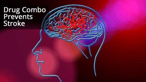 Drug Combo Prevents Stroke, Shows Promise for Clinic