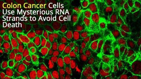 Colon Cancer Cells Use RNA Strands to Evade Cell Death