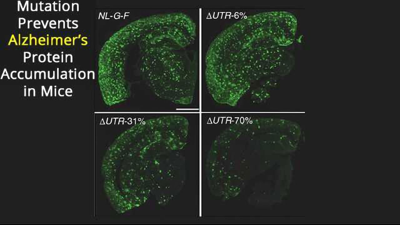 Mouse Mutation Protects Against Alzheimer's