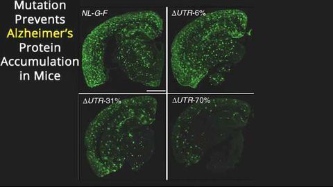 Mouse Mutation Protects Against Alzheimer's