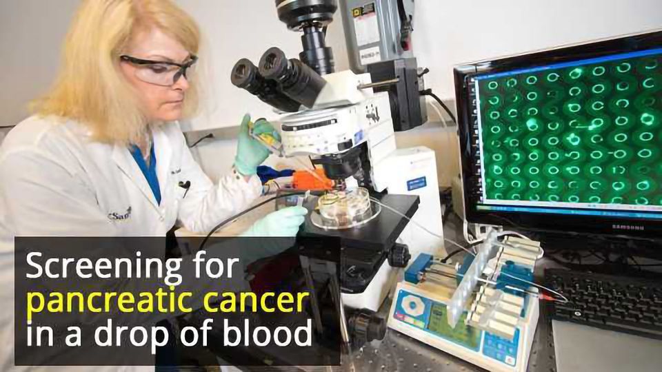 Blood Test Rapidly Detects Signs of Pancreatic Cancer Technology Networks
