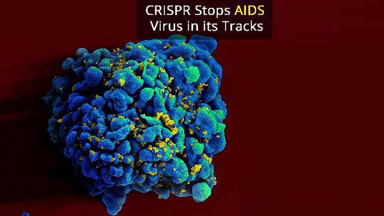 CRISPR Editing Stops HIV Virus in Infected Cells