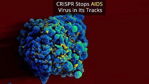 CRISPR Editing Stops HIV Virus in Infected Cells