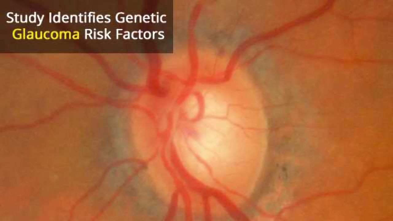 Over 130 Glaucoma Gene Variants Could Help Predict Blindness