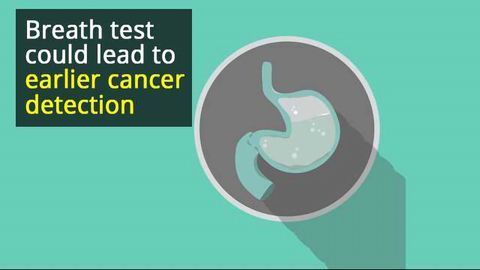 A Breath Test for Early Diagnosis of Oesophageal and Gastric Cancer