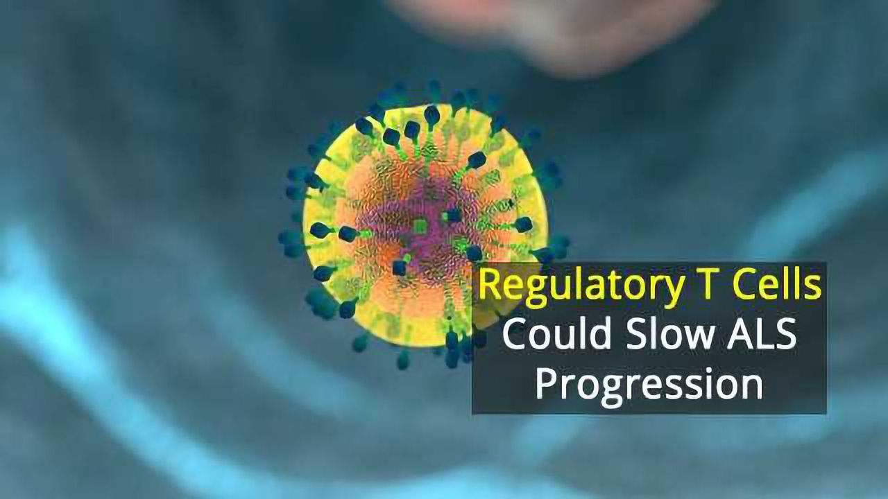Immune Cells Hold Promise In Slowing ALS