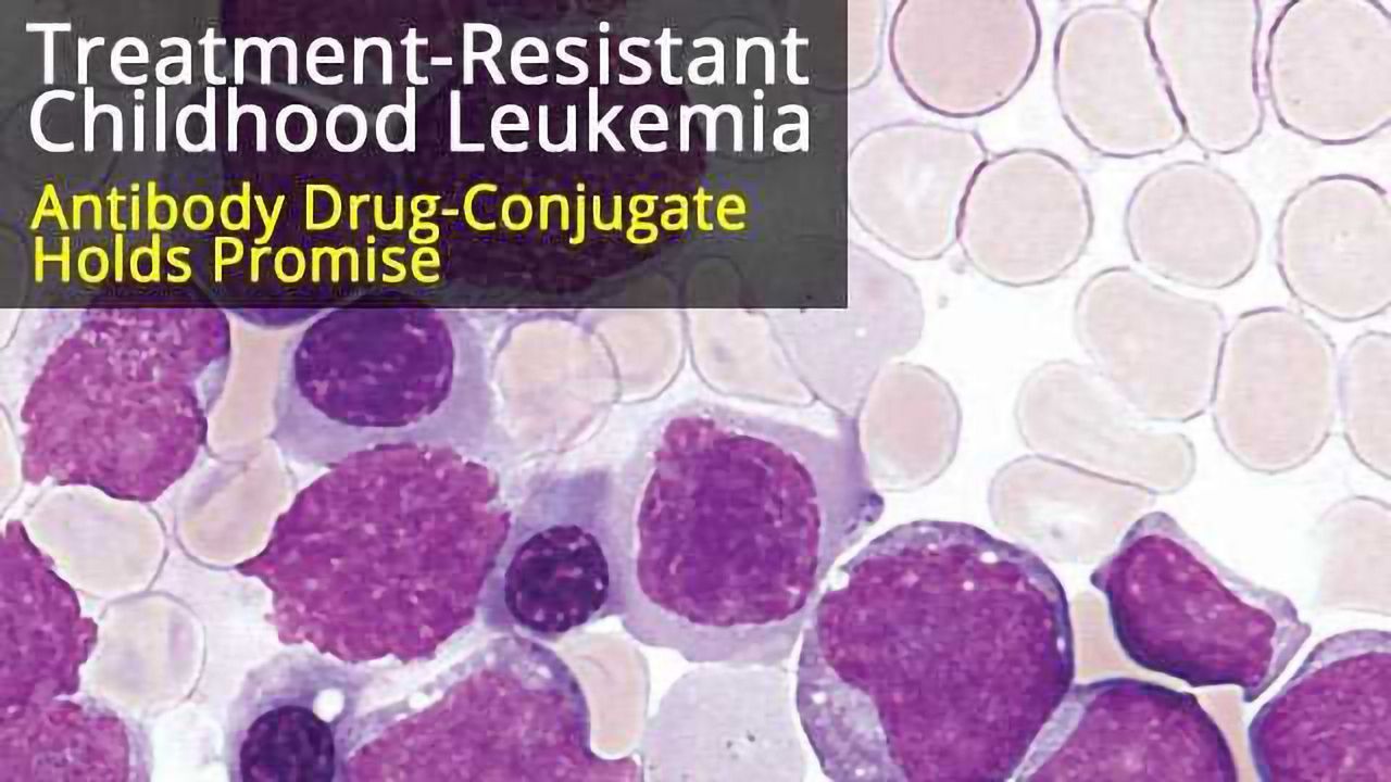 Antibody Drug-Conjugate to Target Treatment-Resistant Childhood Leukemia