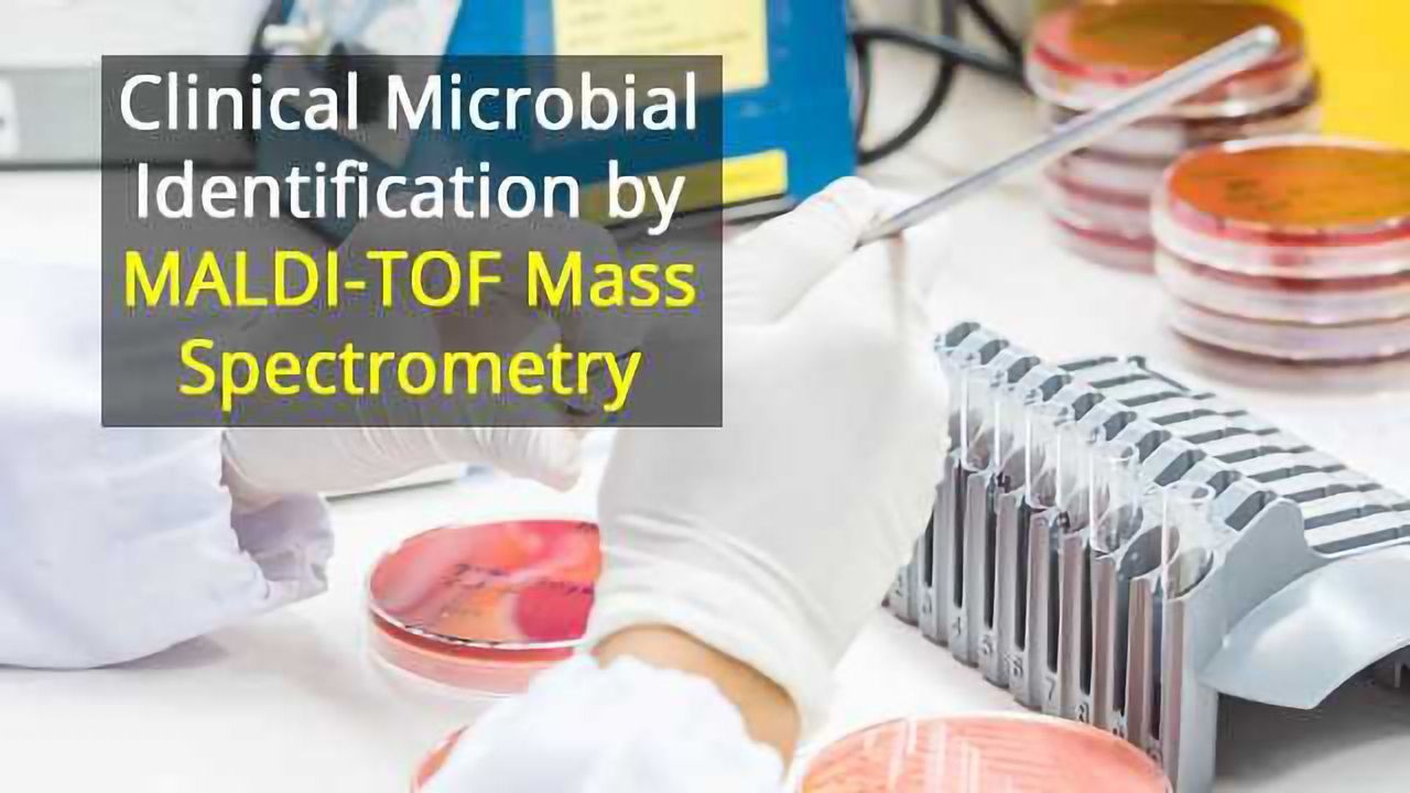 Clinical Microbial Identification by MALDI-TOF Mass Spectrometry