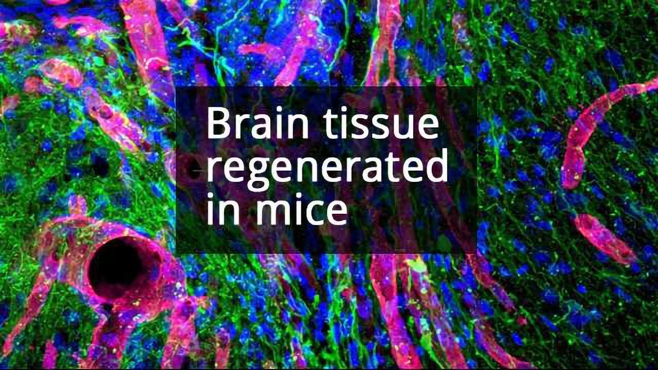 Biomaterial Helps Brain Tissue Regrow After Stroke