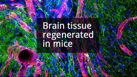Biomaterial Helps Brain Tissue Regrow After Stroke