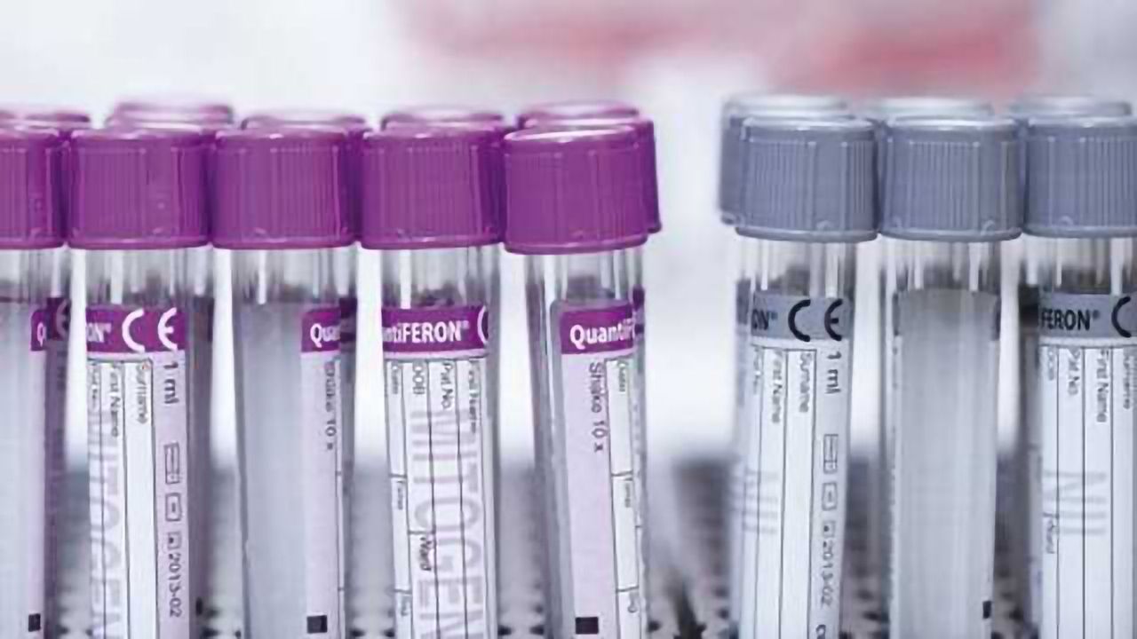 QIAGEN welcomes WHO’s Essential Diagnostics List which includes QuantiFERON-TB Gold