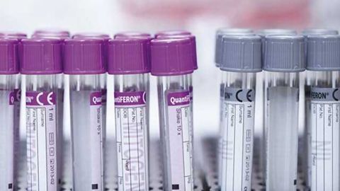 QIAGEN welcomes WHO’s Essential Diagnostics List which includes QuantiFERON-TB Gold
