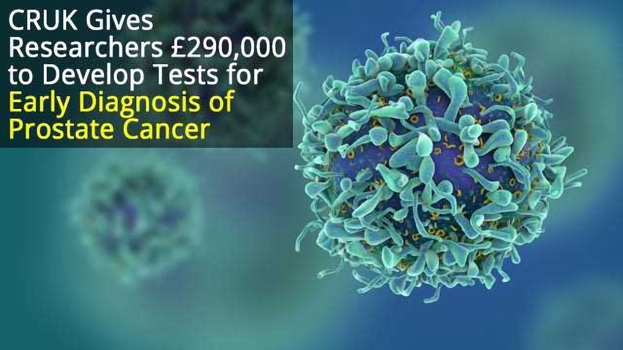 Imperial Receives CRUK Grant to Develop Tests for Early Diagnosis of Prostate Cancer