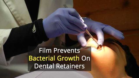 Helping Dental Aligners Fight Off Bacteria