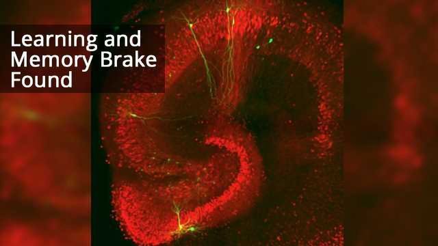 Break Method For Memory Image Protein Acts as Brake on Learning and Memory | Technology Networks