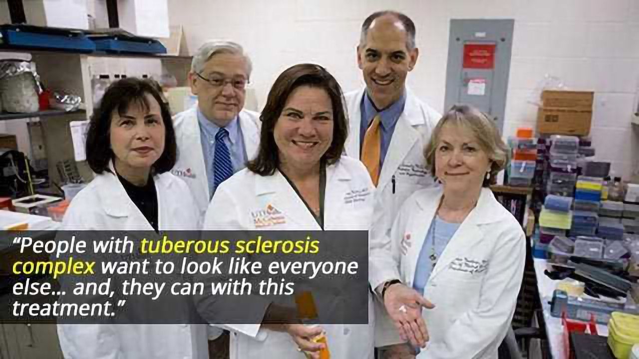 Rapamycin Lotion Reduces Facial Tumors Caused by Tuberous Sclerosis