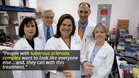 Rapamycin Lotion Reduces Facial Tumors Caused by Tuberous Sclerosis
