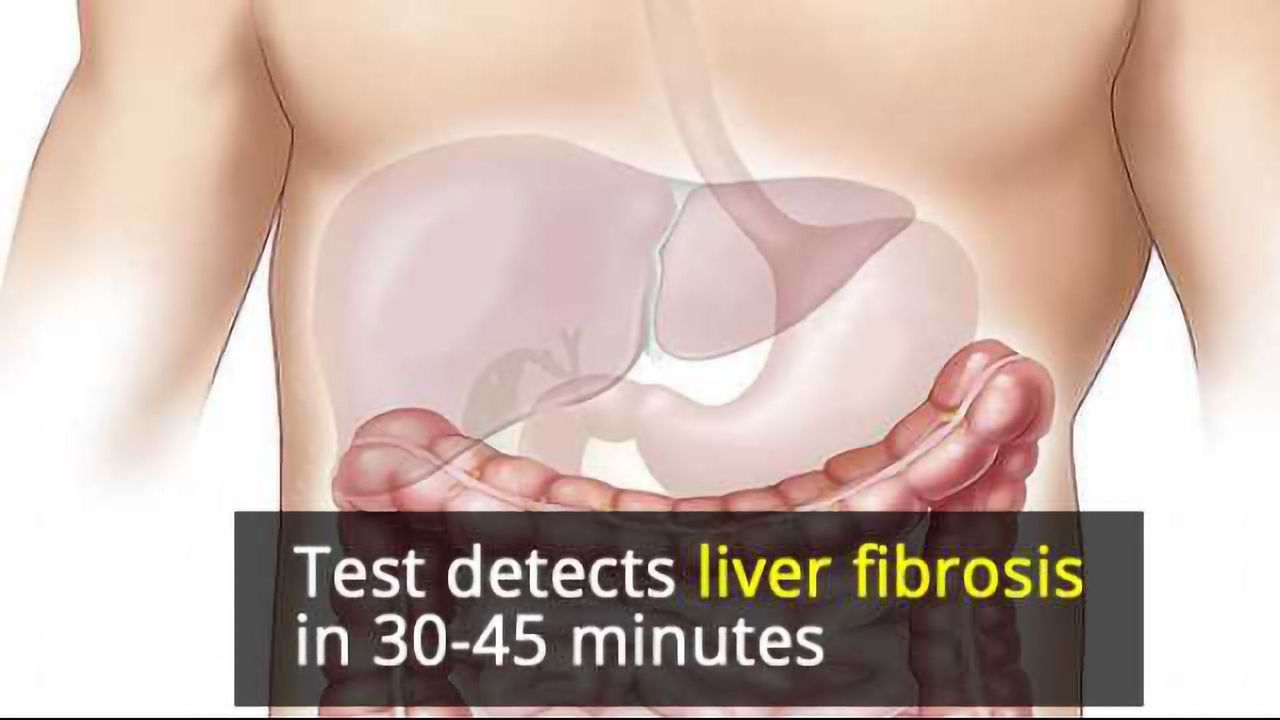 Blood Test Detects Liver Damage in Under an Hour