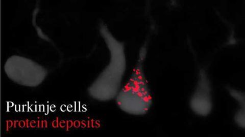 Researchers Identify Gene That Helps Prevent Brain Disease