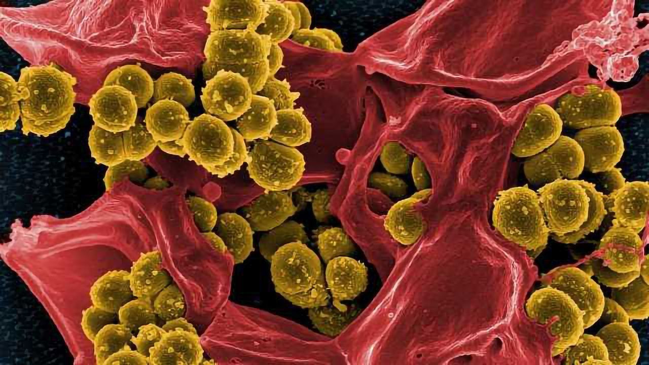 Gut Bacteria Play Critical Role in Anti-Seizure Effects of Ketogenic Diet