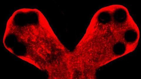 Lung-on-a-Chip Simulates Pulmonary Fibrosis