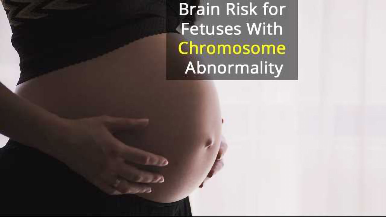 Fetal Chromosome Rearrangement Gives 1 in 5 Risk of Brain Disorder