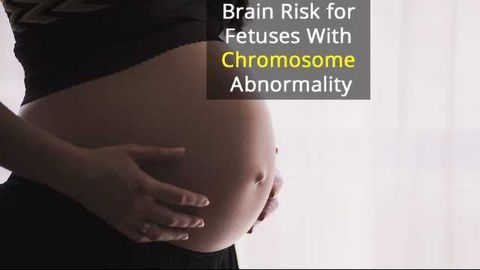 Fetal Chromosome Rearrangement Gives 1 in 5 Risk of Brain Disorder