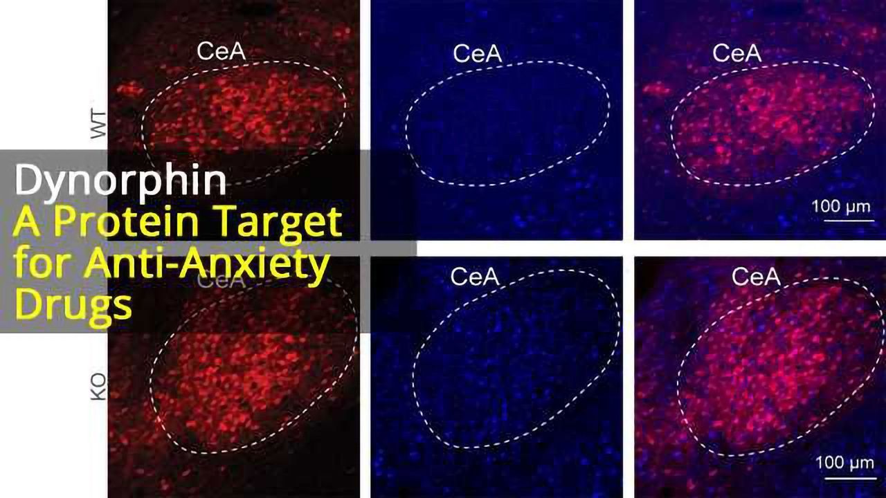 Neuropeptide of Stress: Dynorphin drives anxiety