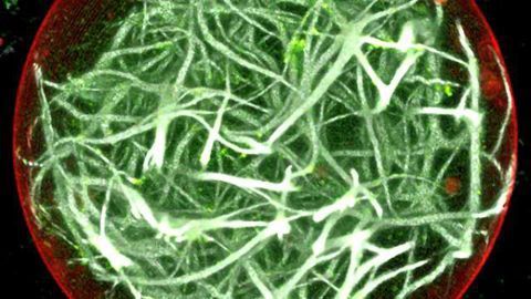 A Photosynthetic Engine for Artificial Cells