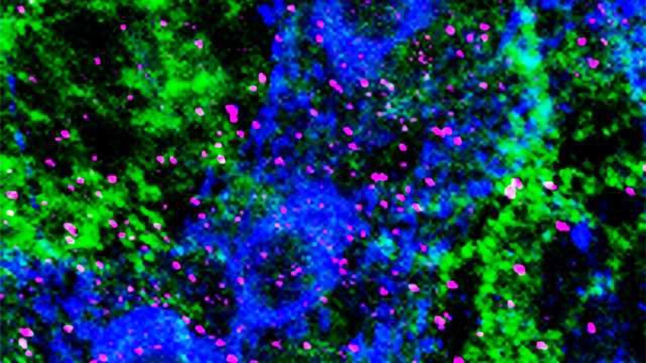 Stress in Infancy ‘Dramatically Alters’ Body’s Organs
