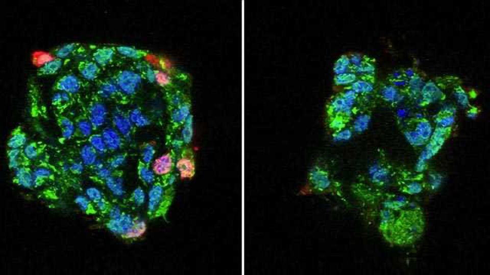 Key Molecule for Flu Infection, a Novel Target for Drug Development? content piece image