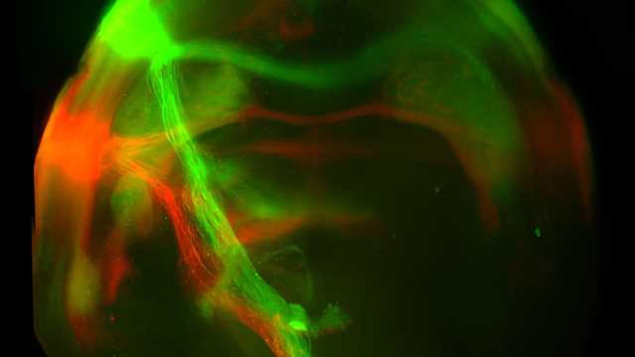 Scientists Switch-off Pleasure From Food, Silence Sweet-tooth Circuitry
