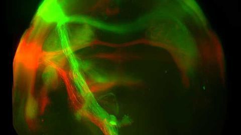 Scientists Switch-off Pleasure From Food, Silence Sweet-tooth Circuitry