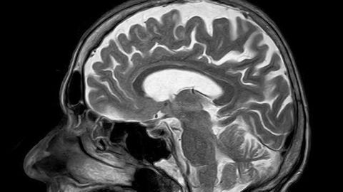 MRI Technique Enables Visualization of Brain in Motion