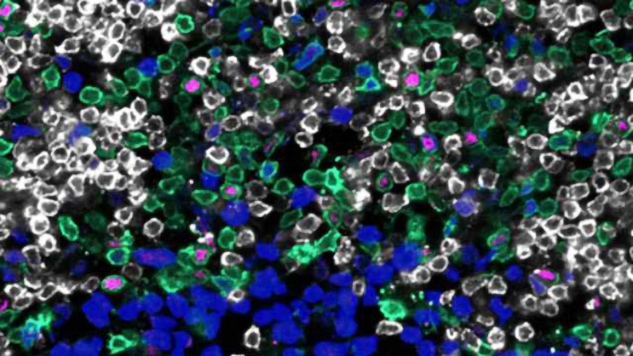 Improving Organ Transplant Success By Understanding the Immune System's Role