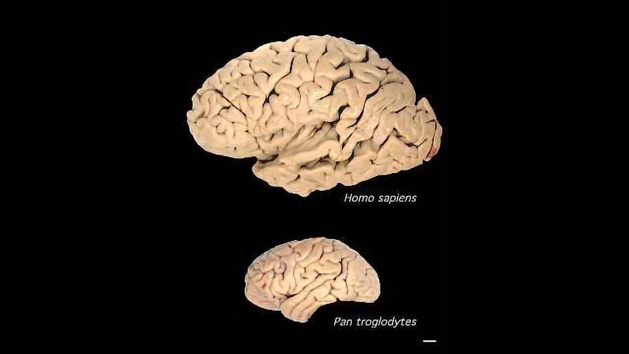 These Genes Supersized the Human Brain