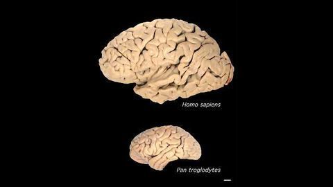 These Genes Supersized the Human Brain