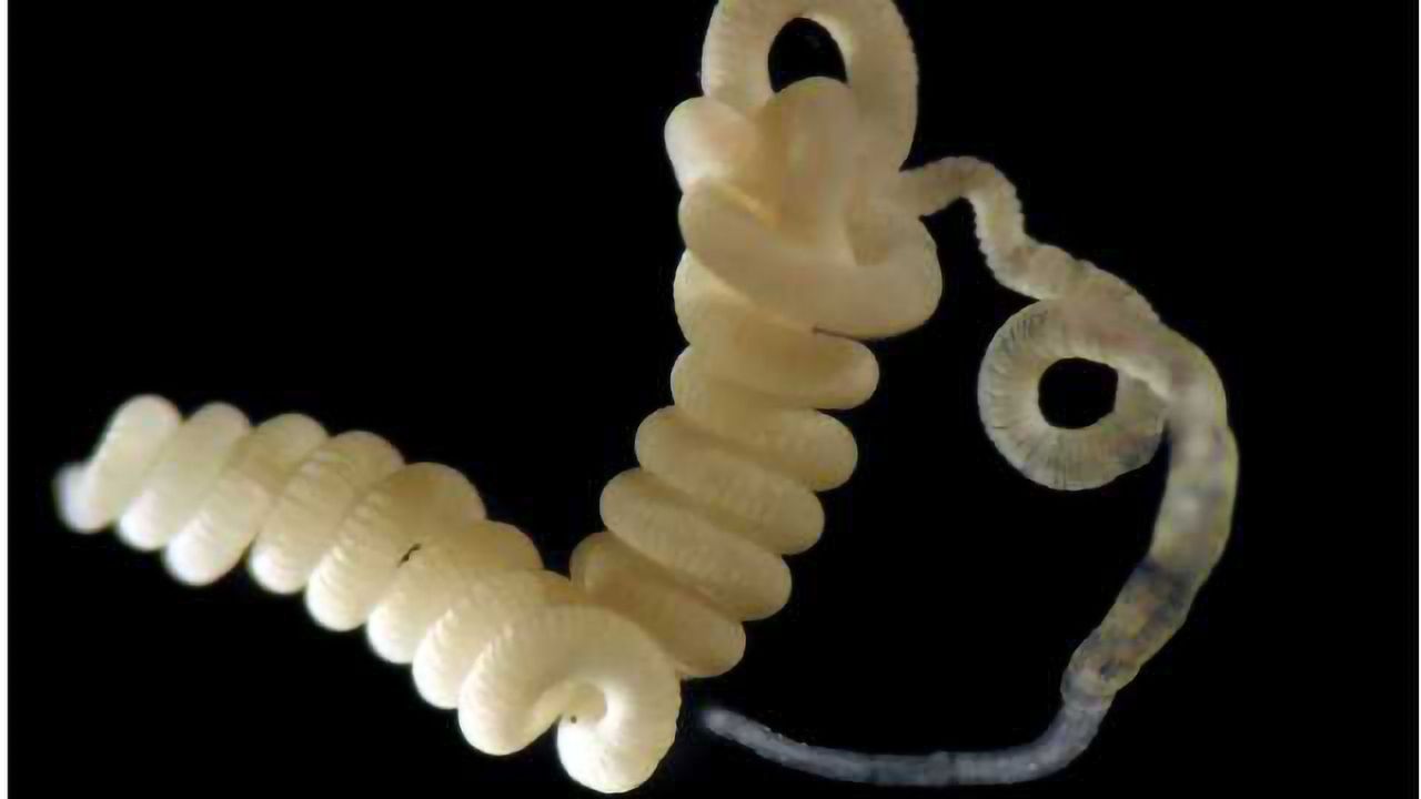 Taking a Close Look at What Microbes Munch