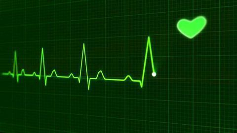 High-sensitivity Troponin Test Reduces Risk of Future Heart Attack