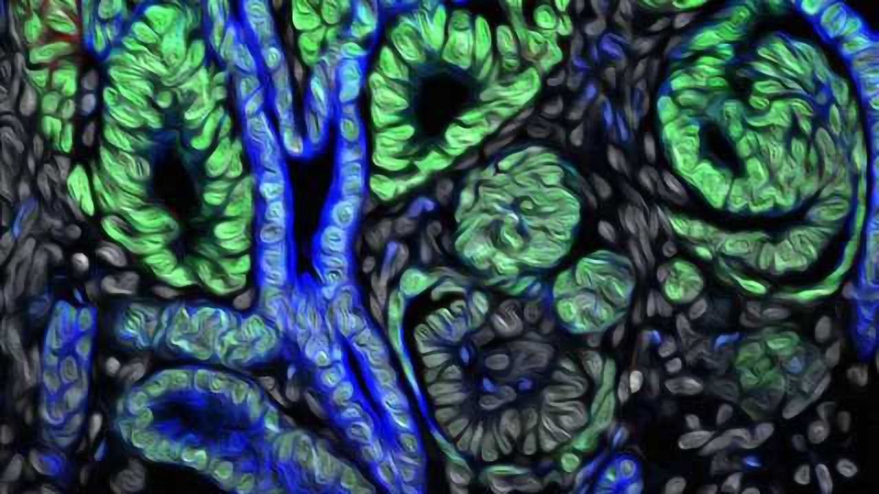 Timing is Everything to Build Kidneys from Scratch