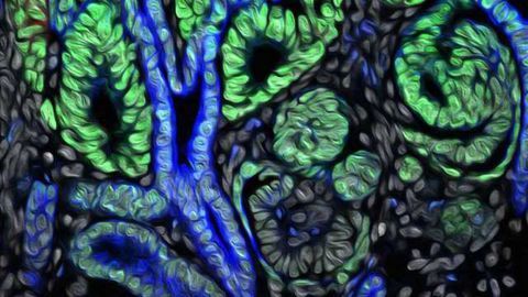 Timing is Everything to Build Kidneys from Scratch