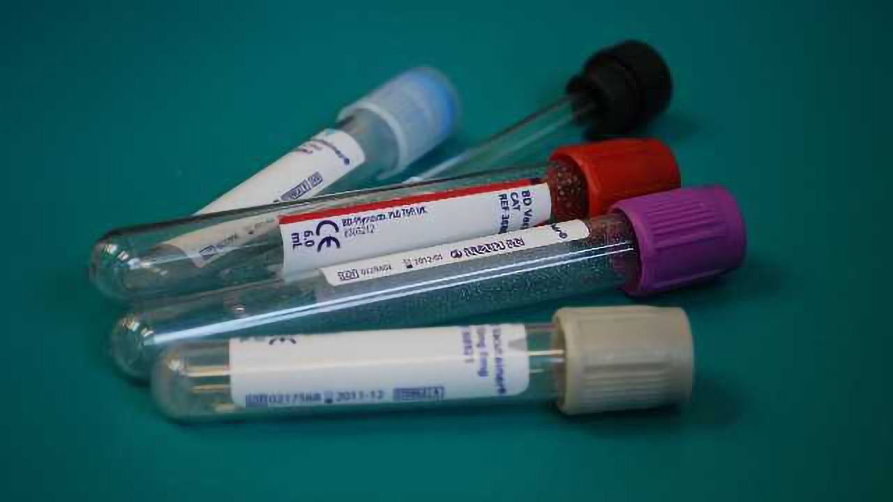 A Step Closer to a DNA Test for Liver Cancer