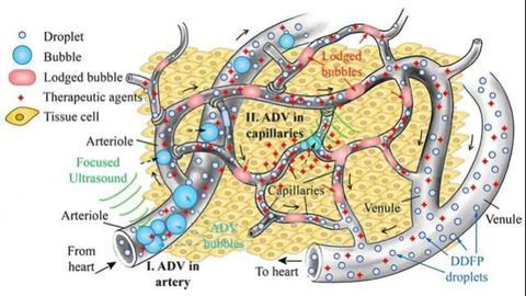 Combating Cancer: Microbubbles Cut Off Blood Supply and Help Deliver Drugs