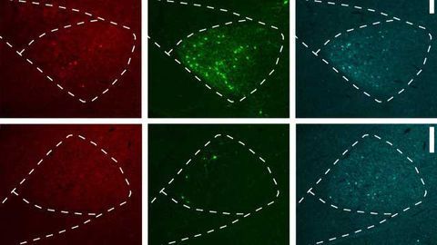 Overcoming Tropism in Retrograde Brain Cell Circuit Tracing